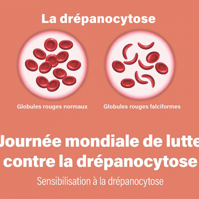 Journée Mondiale de la Drépanocytose