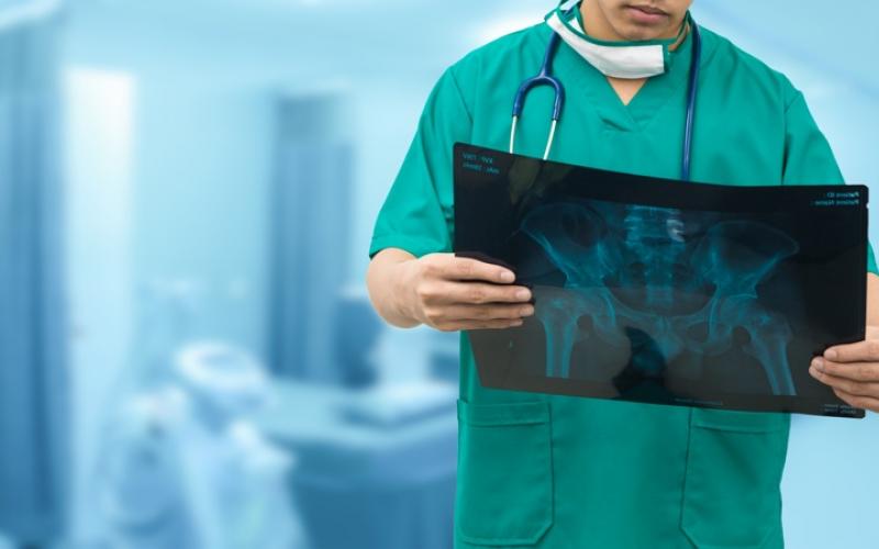 un médecin qui regarde une radiographie 